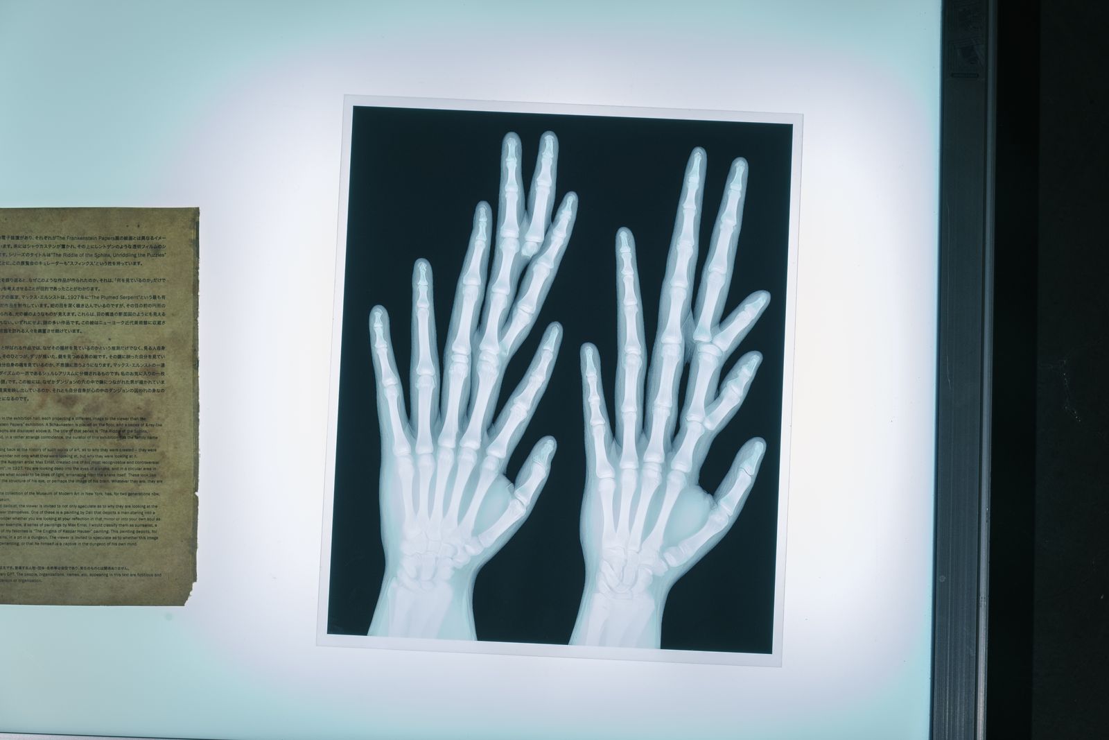 The Riddle of the Sphinx, Unriddling the Puzzles