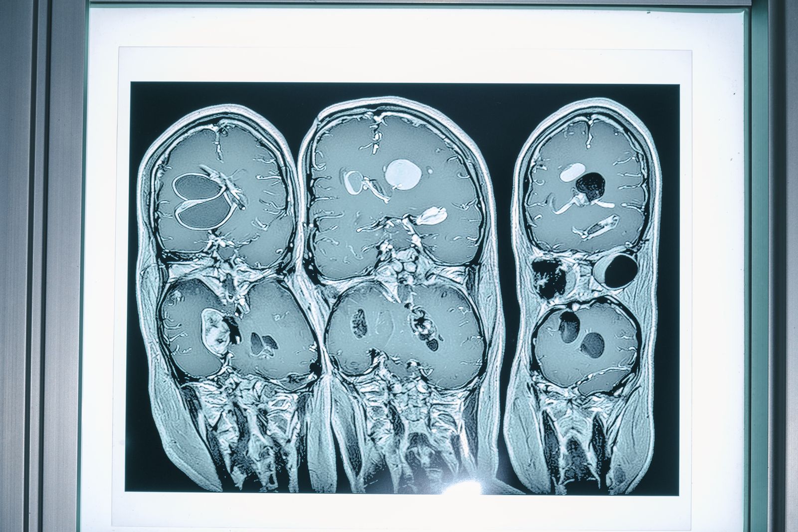 The Riddle of the Sphinx, Unriddling the Puzzles