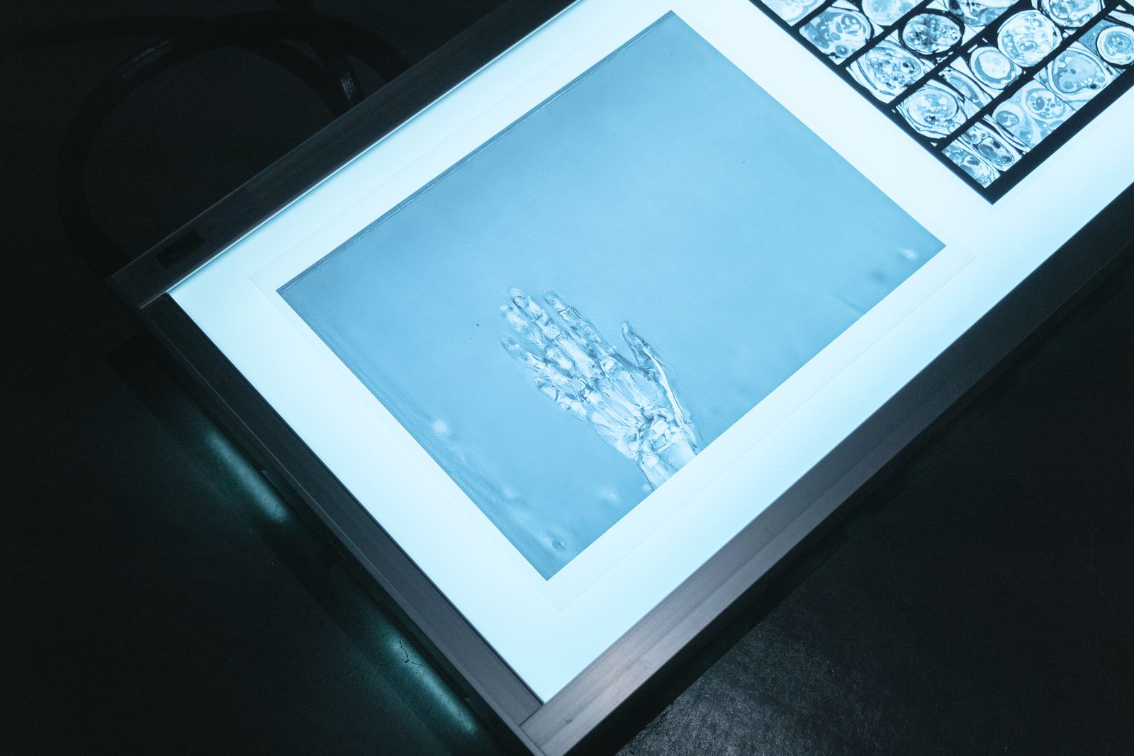 The Riddle of the Sphinx, Unriddling the Puzzles