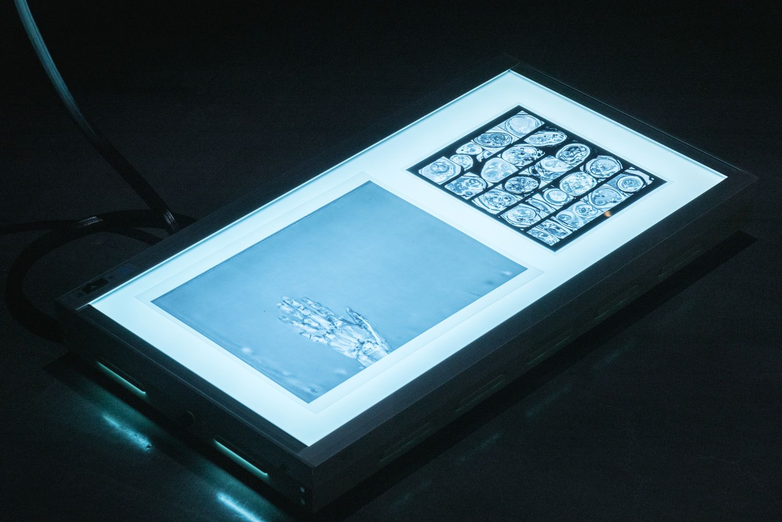 The Riddle of the Sphinx, Unriddling the Puzzles