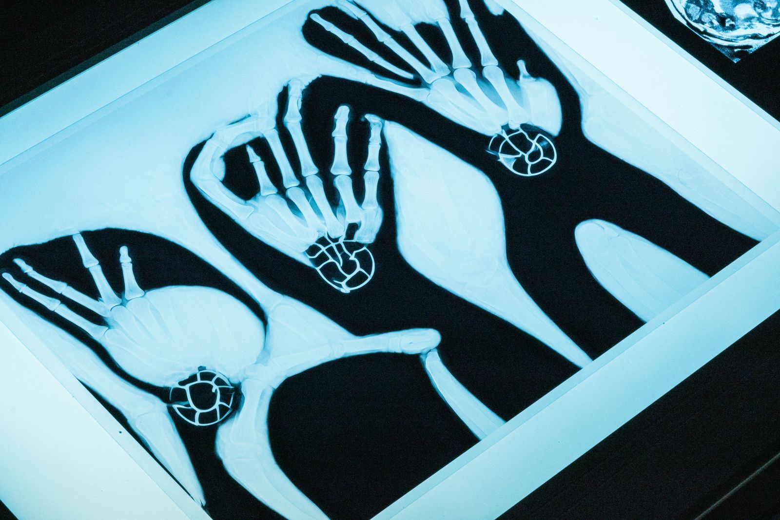 The Riddle of the Sphinx, Unriddling the Puzzles